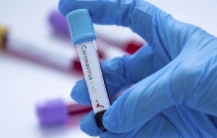 Menemen’de şok, 10 kişinin Covid-19 testi pozitif çıktı